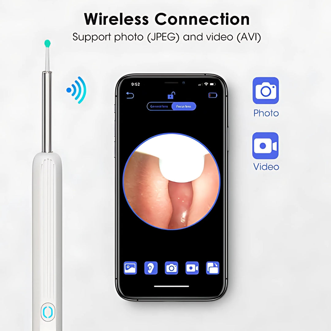 ClearEar | Nettoyeur auriculaire avec caméra HD