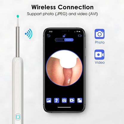 ClearEar | Nettoyeur auriculaire avec caméra HD