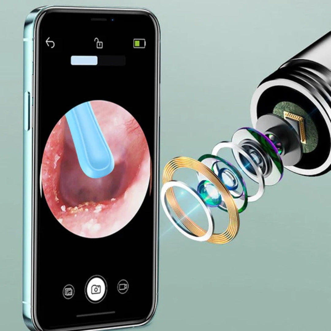 ClearEar | Nettoyeur auriculaire avec caméra HD